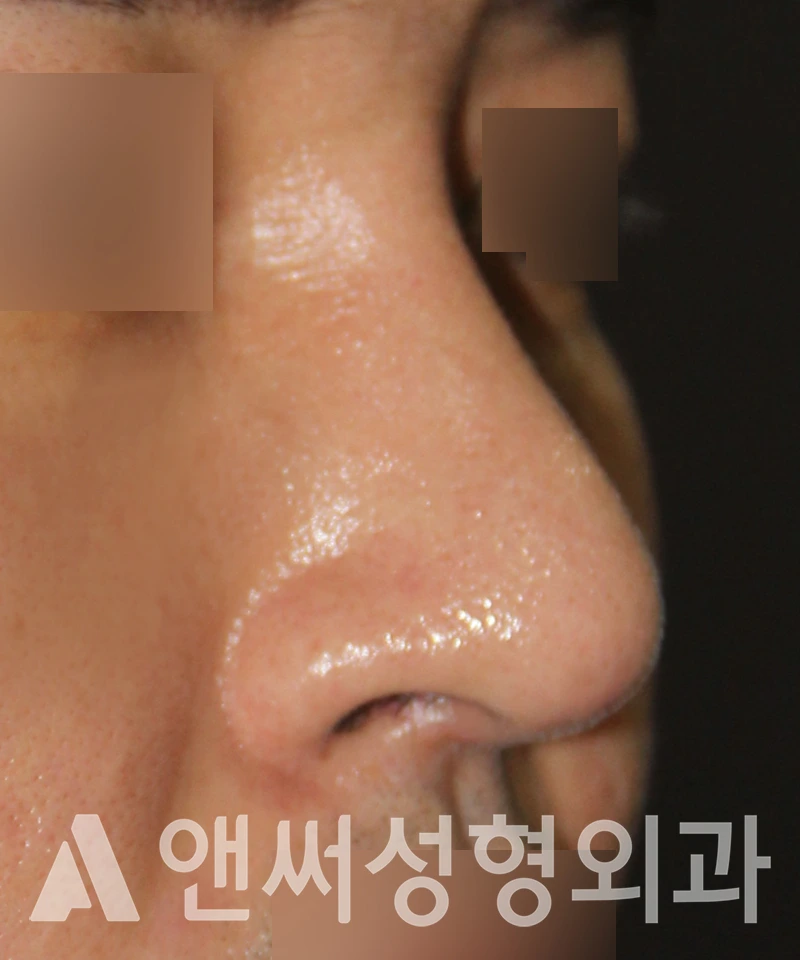 Answer Plastic Surgery case 547: After