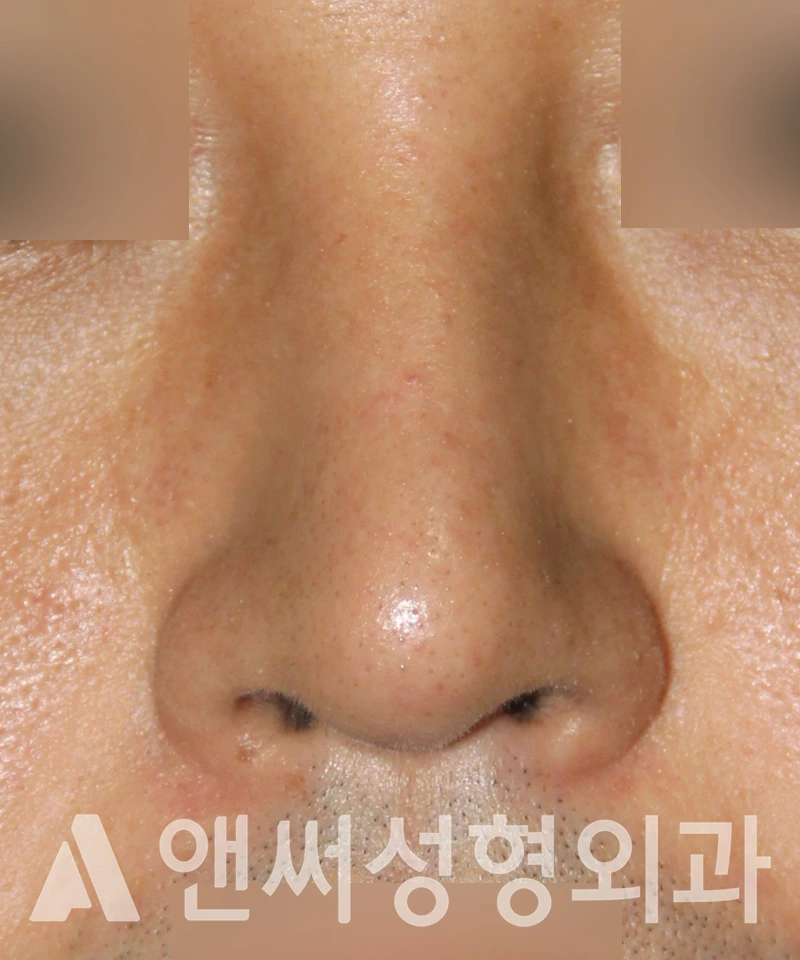 Answer Plastic Surgery case 544: After
