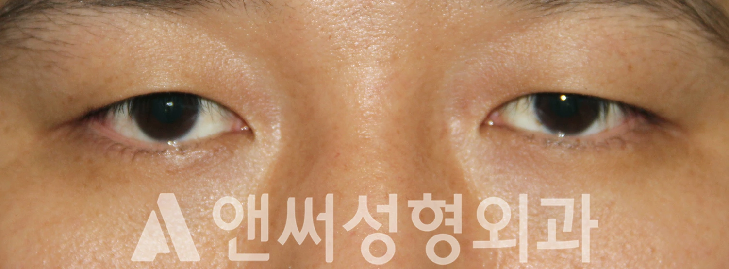 Answer Plastic Surgery case 543: Before
