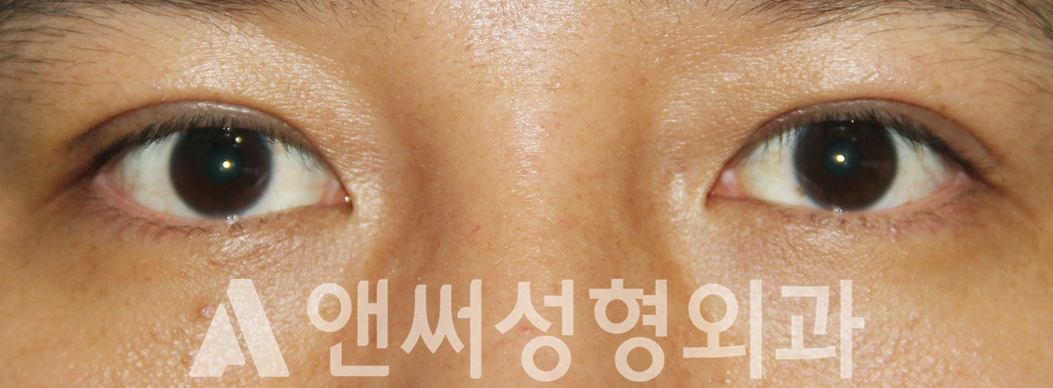 Answer Plastic Surgery case 543: After