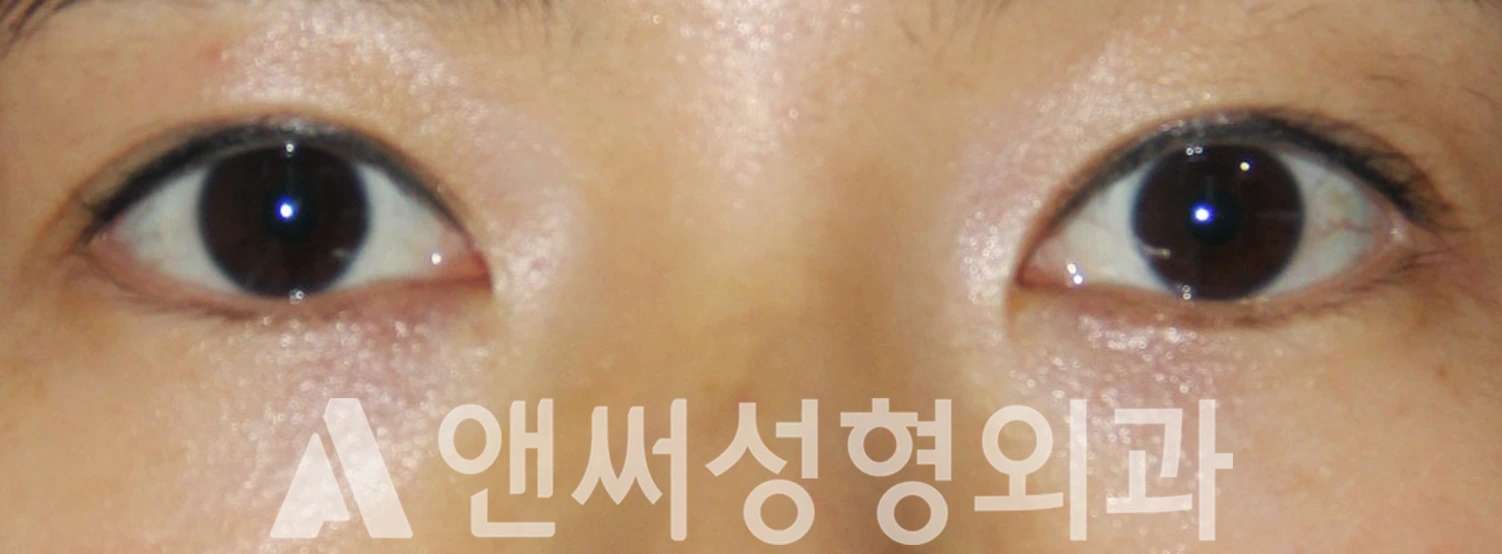 Answer Plastic Surgery case 542: After