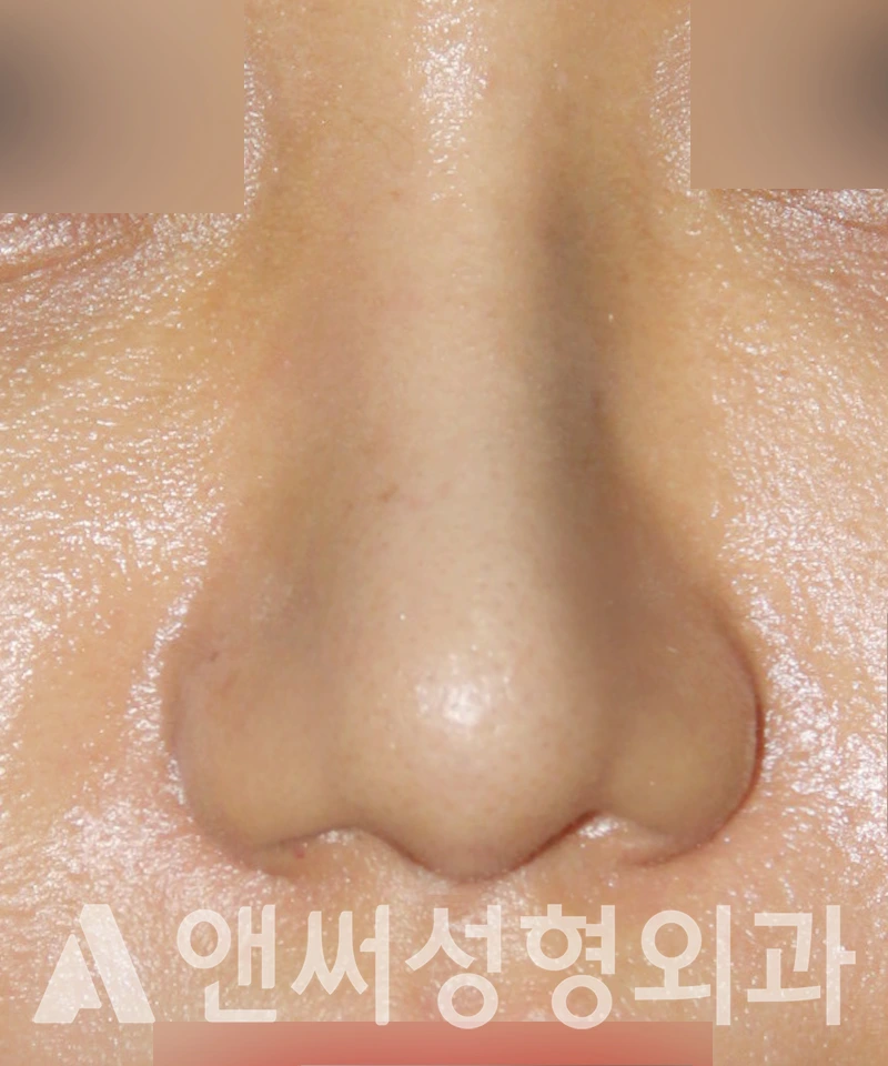 Answer Plastic Surgery case 541: After