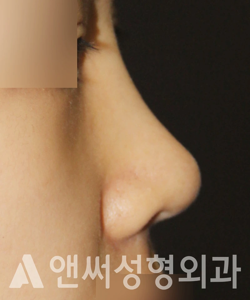 Answer Plastic Surgery case 540: After
