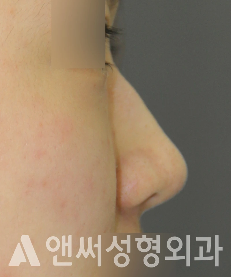 Answer Plastic Surgery case 539: Before