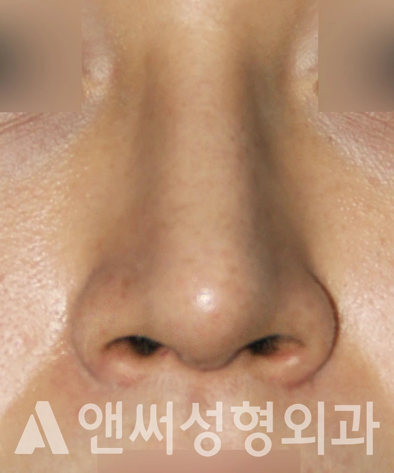 Answer Plastic Surgery case 538: After
