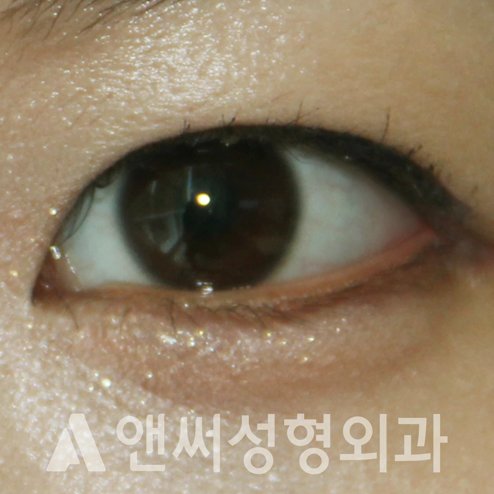 Answer Plastic Surgery case 536: After
