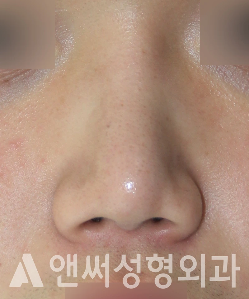 Answer Plastic Surgery case 535: After
