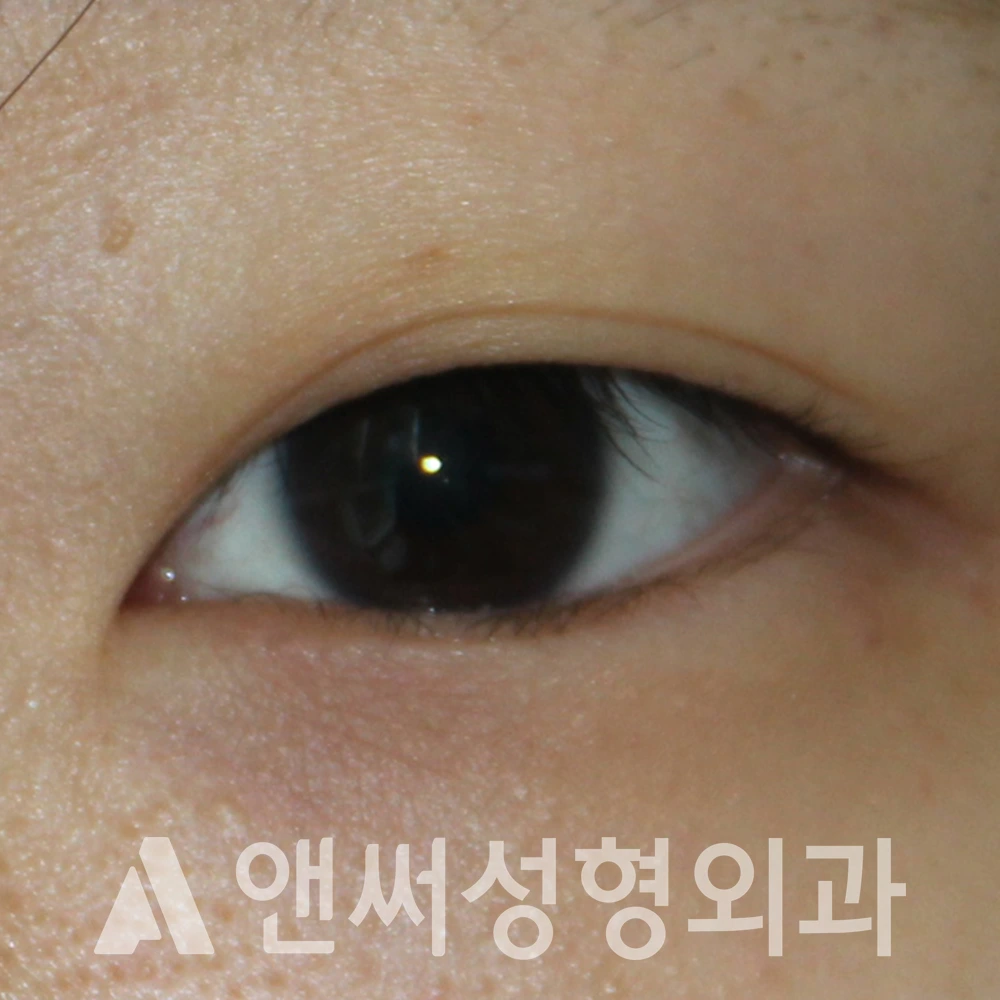 Answer Plastic Surgery case 534: Before