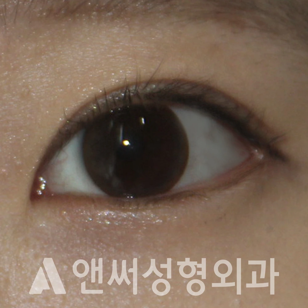 Answer Plastic Surgery case 534: After