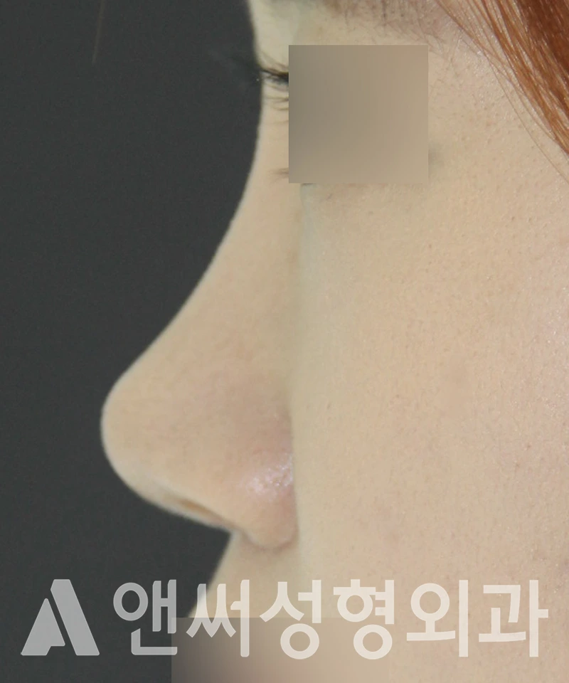 Answer Plastic Surgery case 531: After