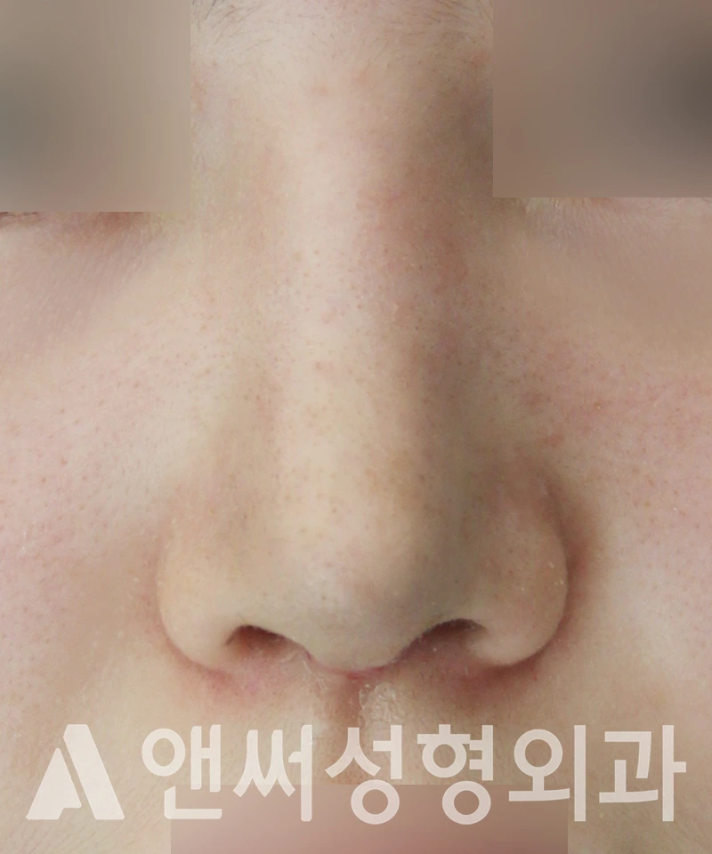 Answer Plastic Surgery case 529: After