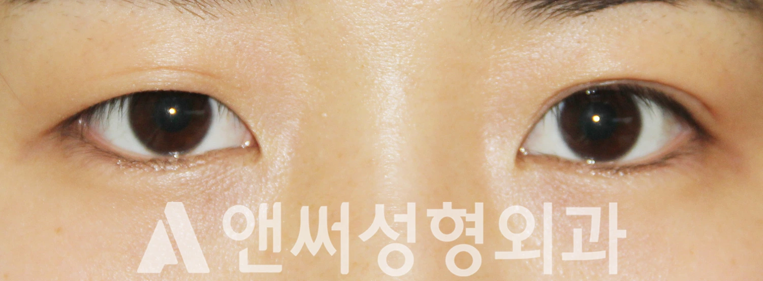 Answer Plastic Surgery case 528: Before