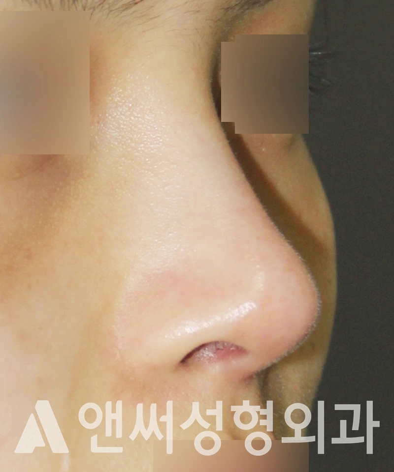 Answer Plastic Surgery case 527: After