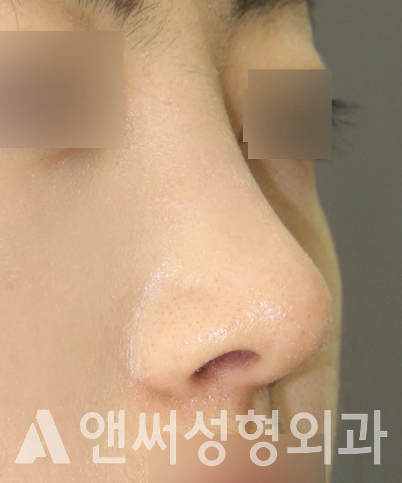 Answer Plastic Surgery case 525: After