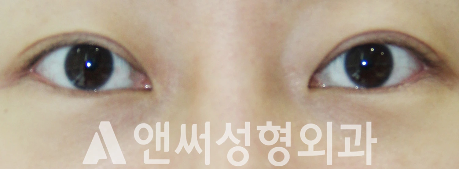 Answer Plastic Surgery case 524: After