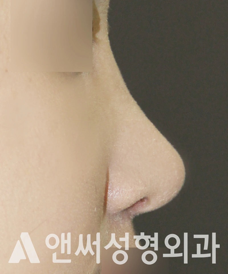 Answer Plastic Surgery case 523: After