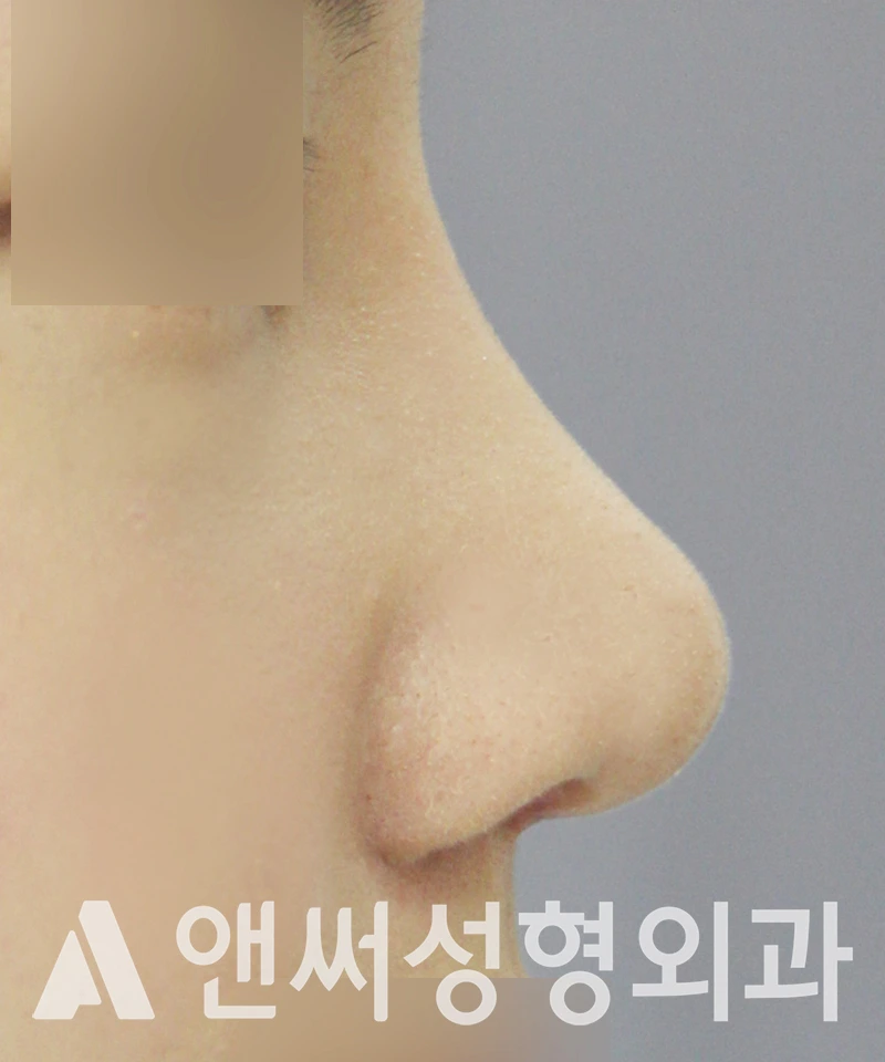 Answer Plastic Surgery case 522: After