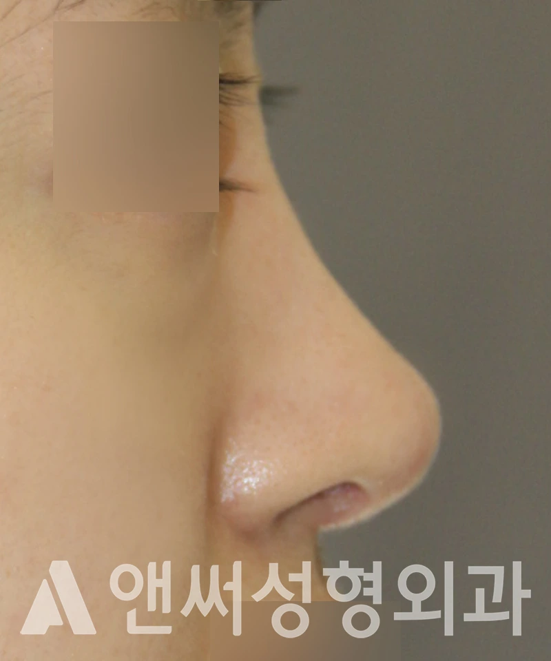 Answer Plastic Surgery case 521: After