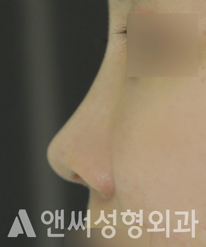 Answer Plastic Surgery case 520: After