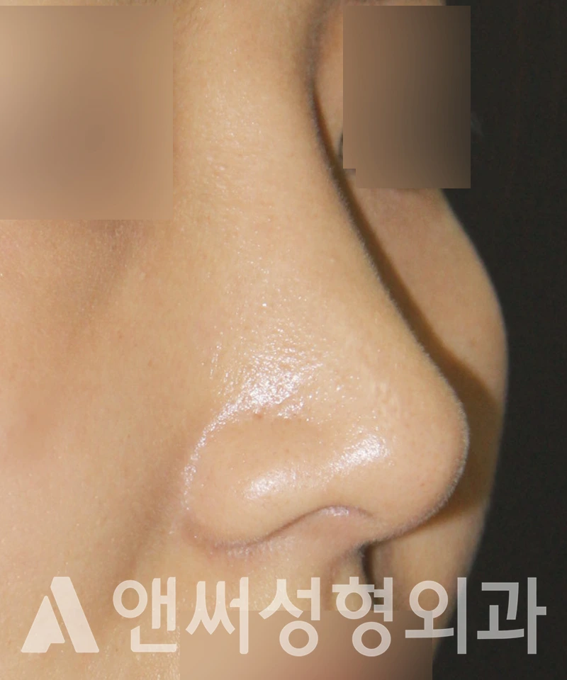 Answer Plastic Surgery case 519: After