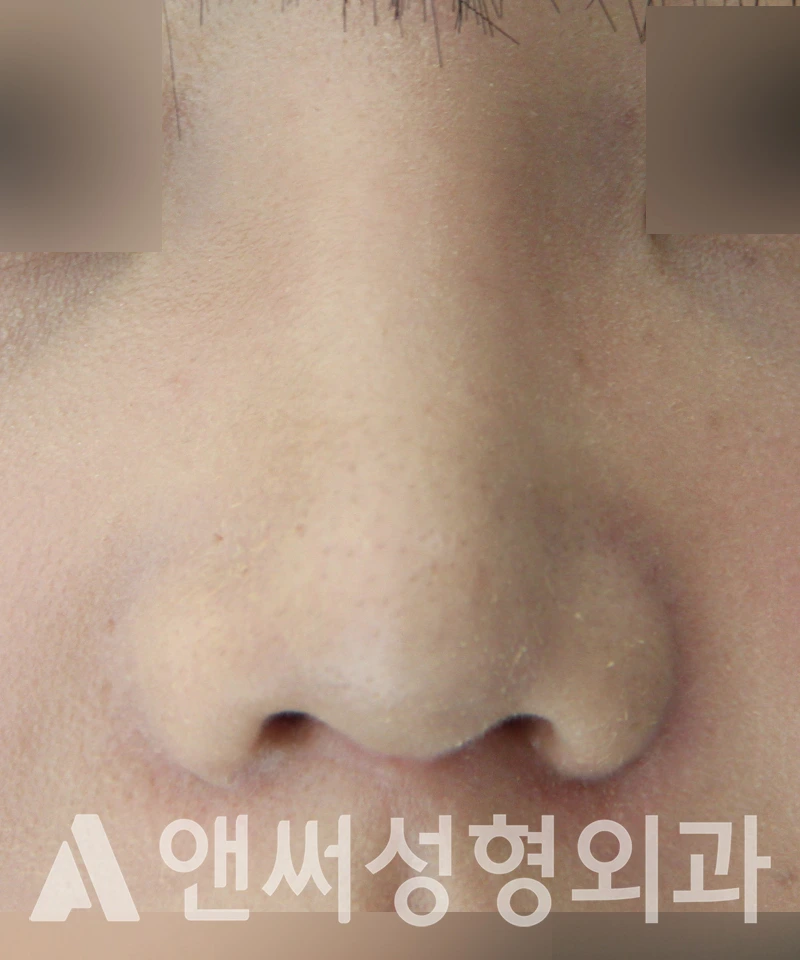 Answer Plastic Surgery case 518: After