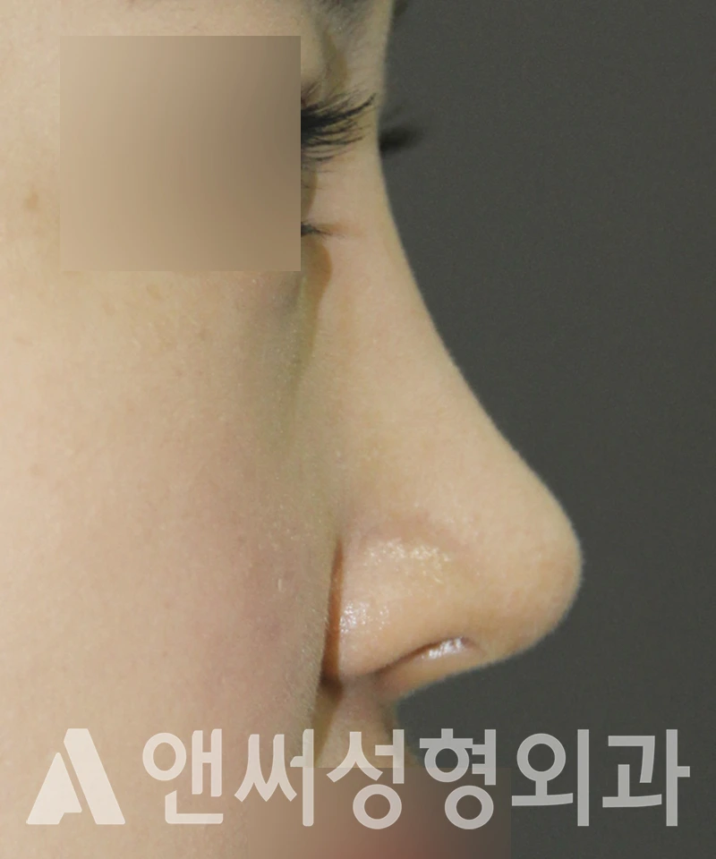Answer Plastic Surgery case 517: After
