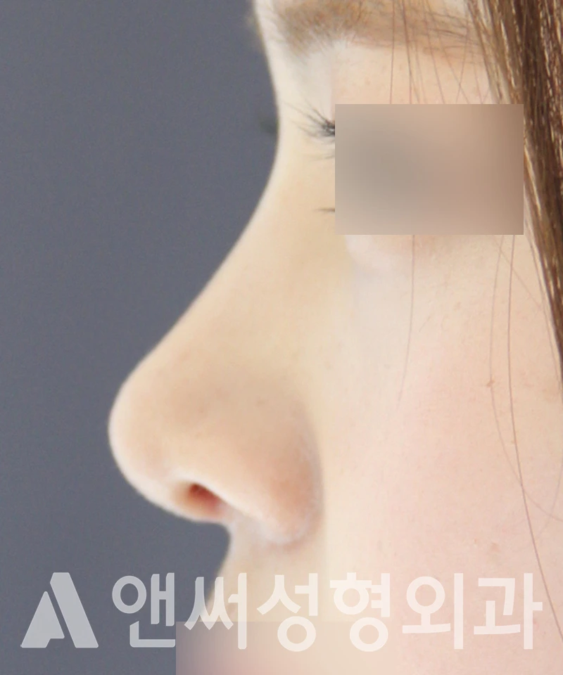 Answer Plastic Surgery case 516: After