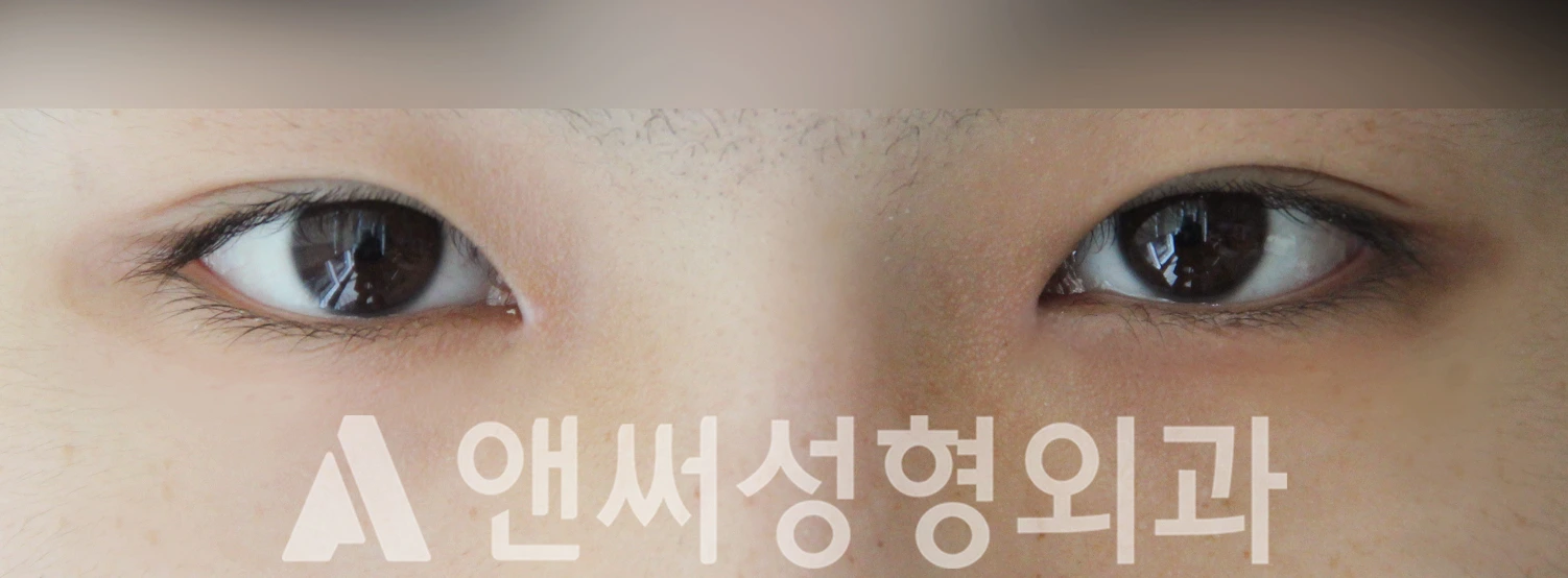 Answer Plastic Surgery case 515: After