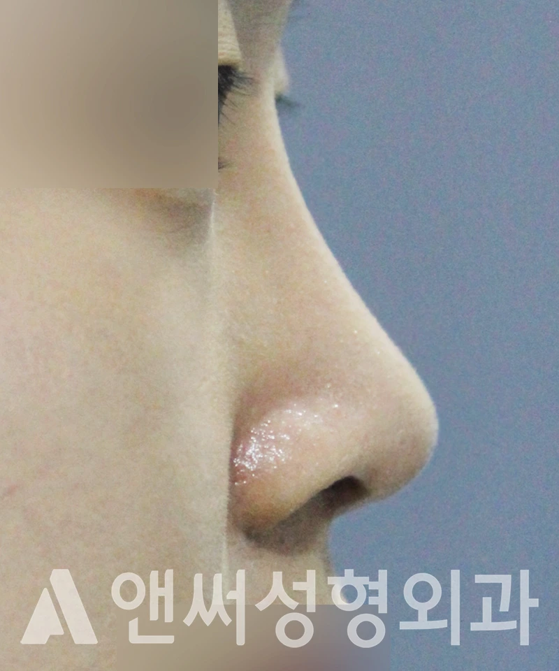 Answer Plastic Surgery case 514: After
