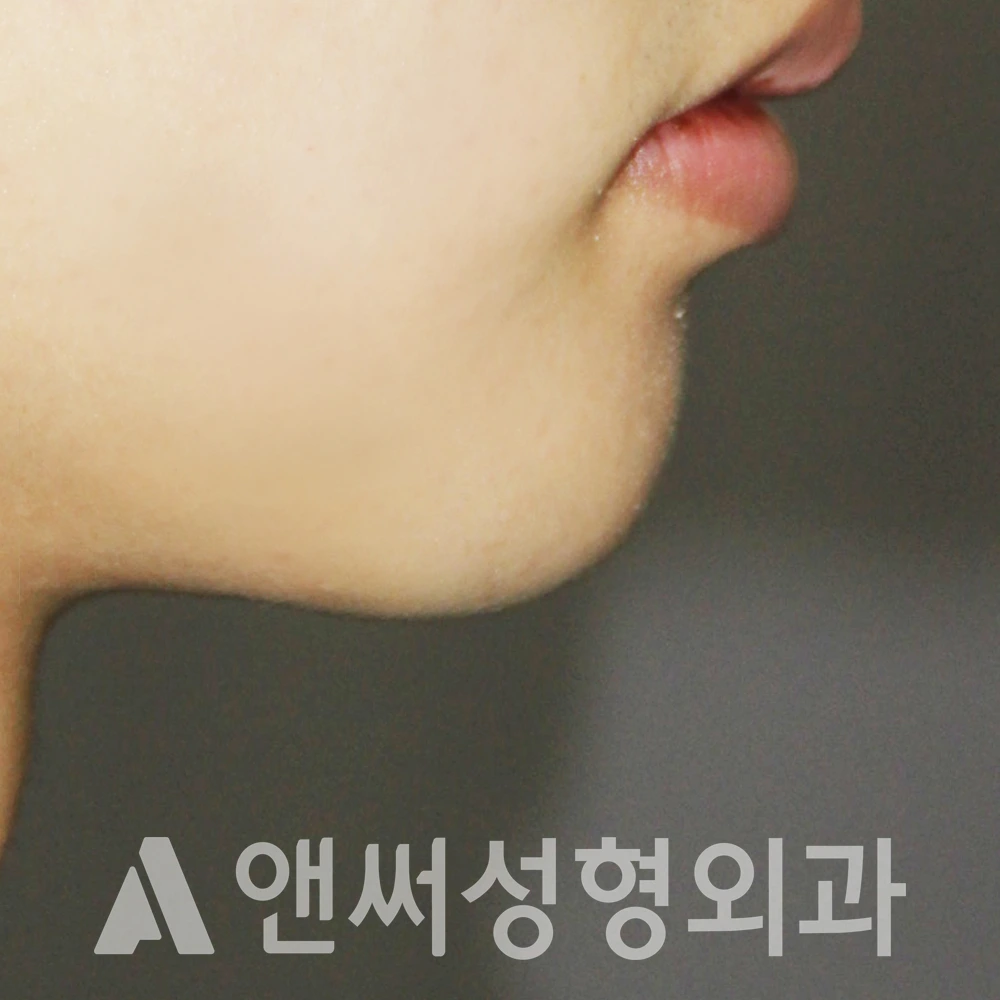 Answer Plastic Surgery case 513: After