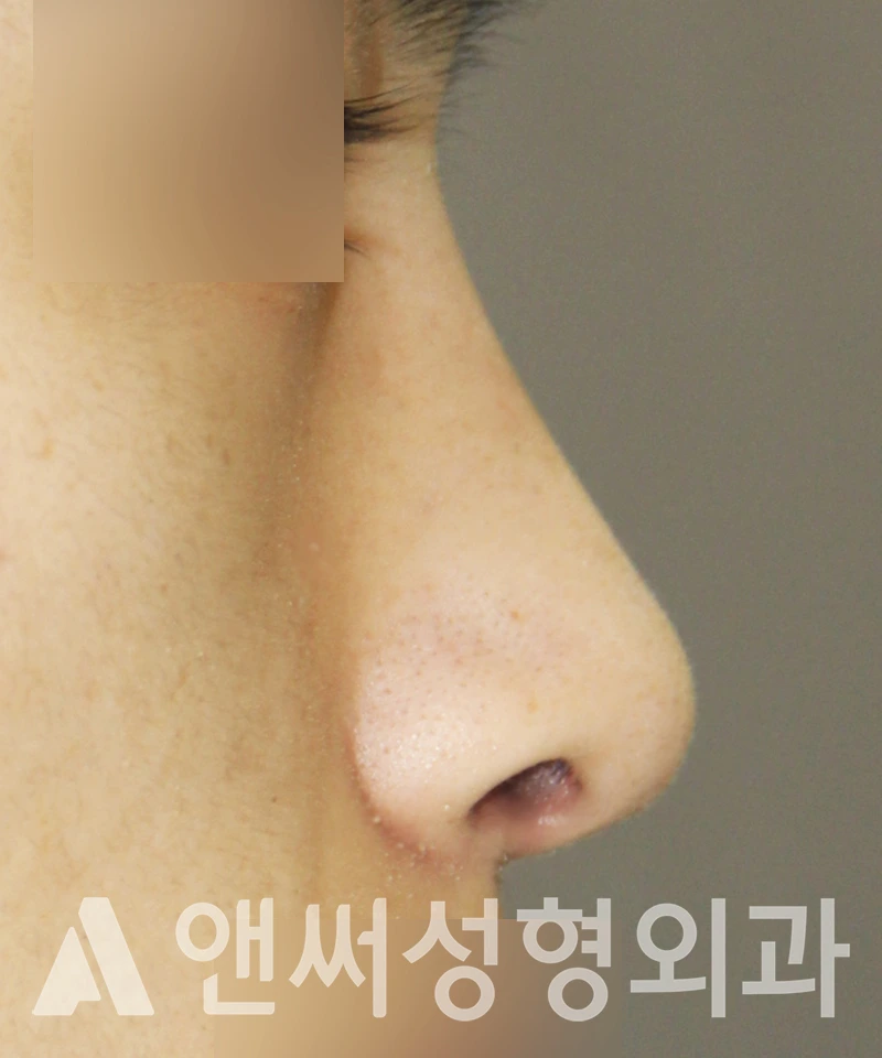 Answer Plastic Surgery case 512: After