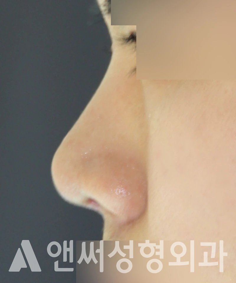 Answer Plastic Surgery case 511: After