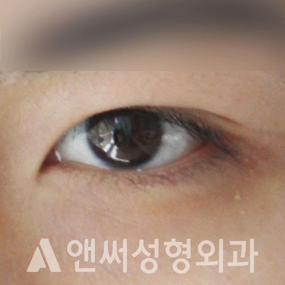 Answer Plastic Surgery case 510: After