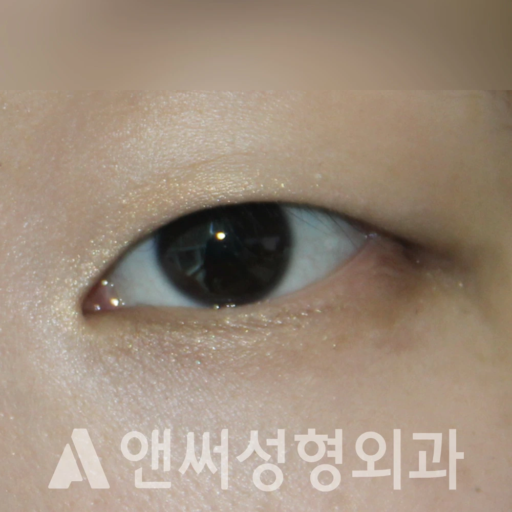 Answer Plastic Surgery case 509: Before