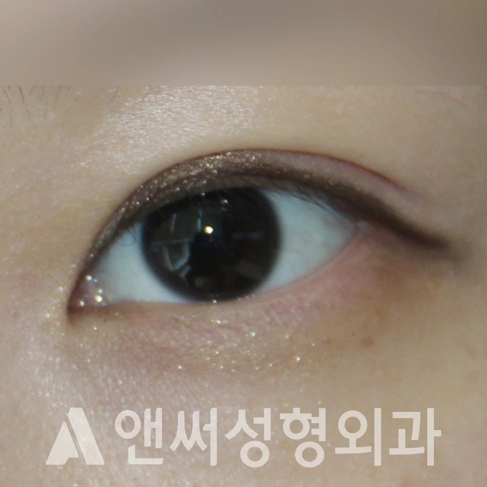 Answer Plastic Surgery case 509: After