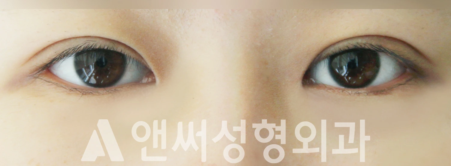 Answer Plastic Surgery case 508: After
