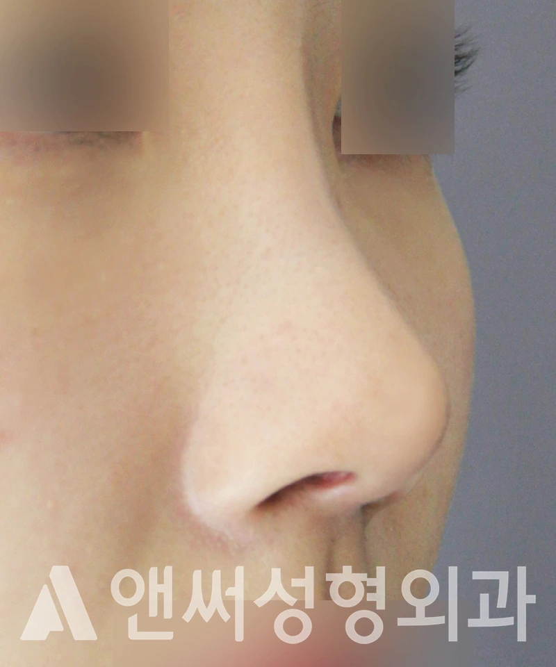 Answer Plastic Surgery case 507: After