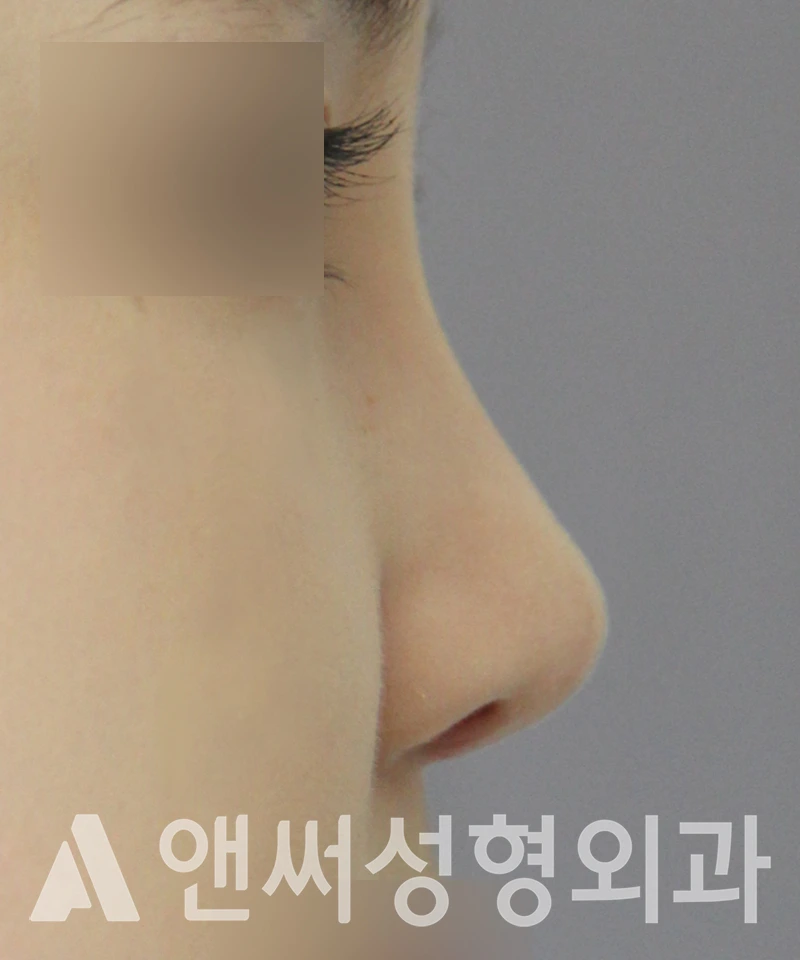 Answer Plastic Surgery case 506: After
