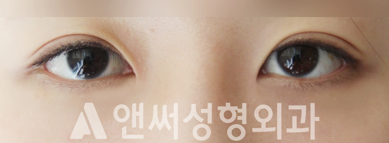 Answer Plastic Surgery case 505: After
