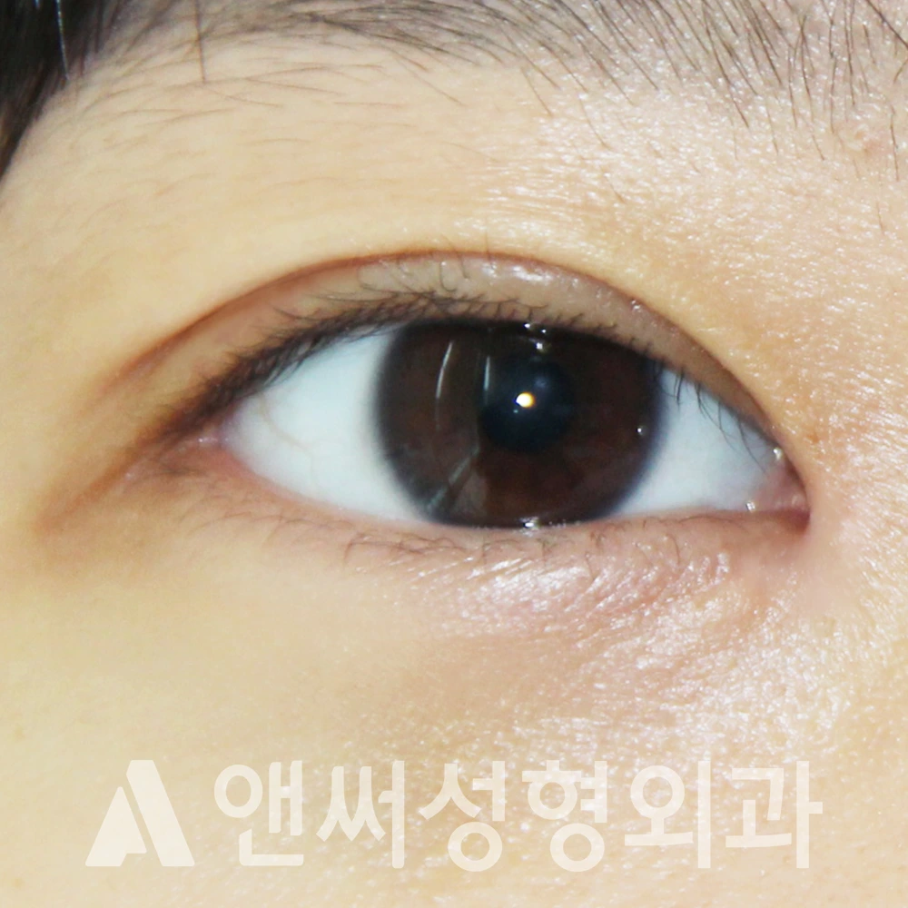 Answer Plastic Surgery case 504: After