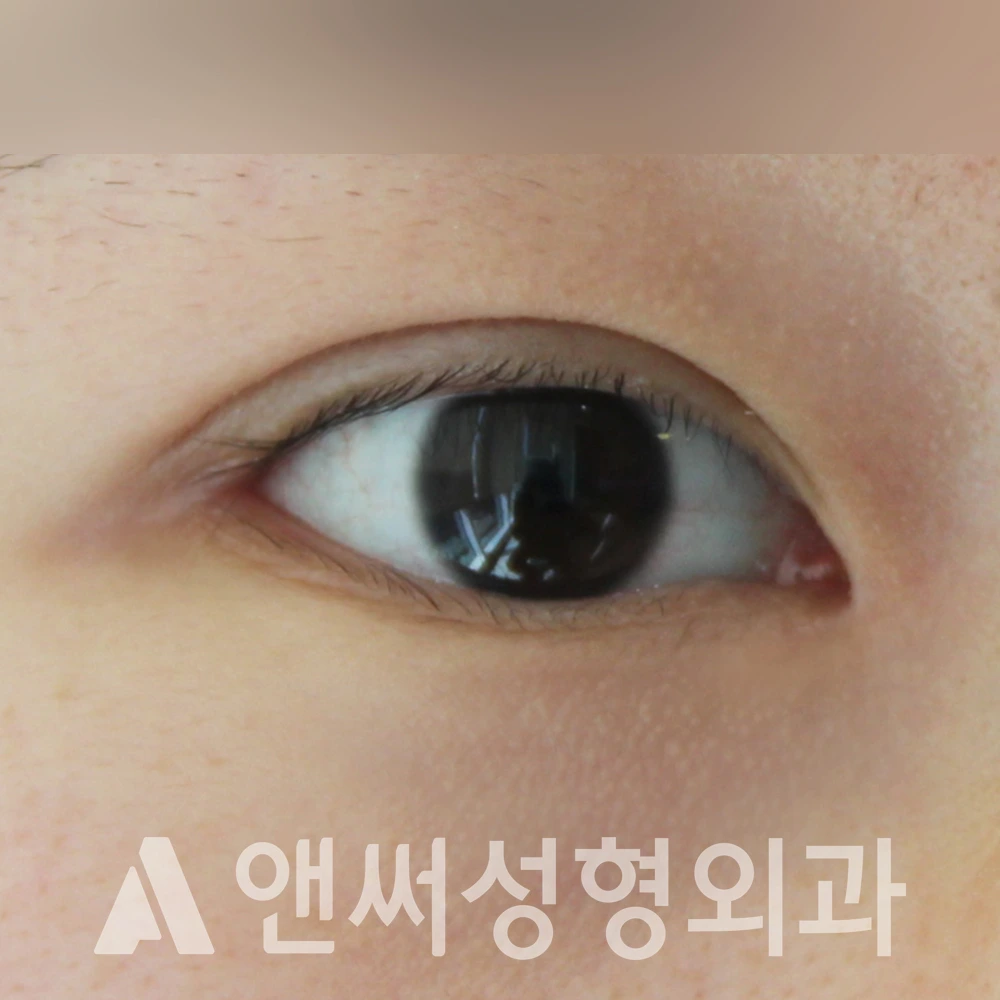 Answer Plastic Surgery case 503: After