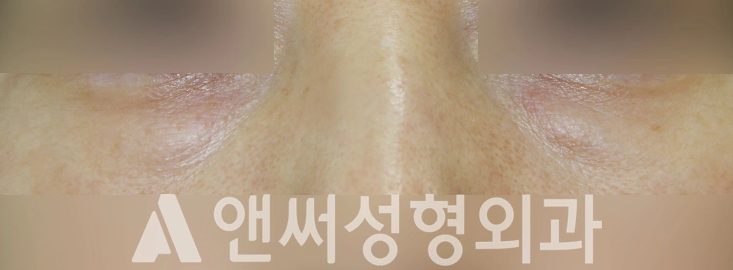 Answer Plastic Surgery case 502: Before