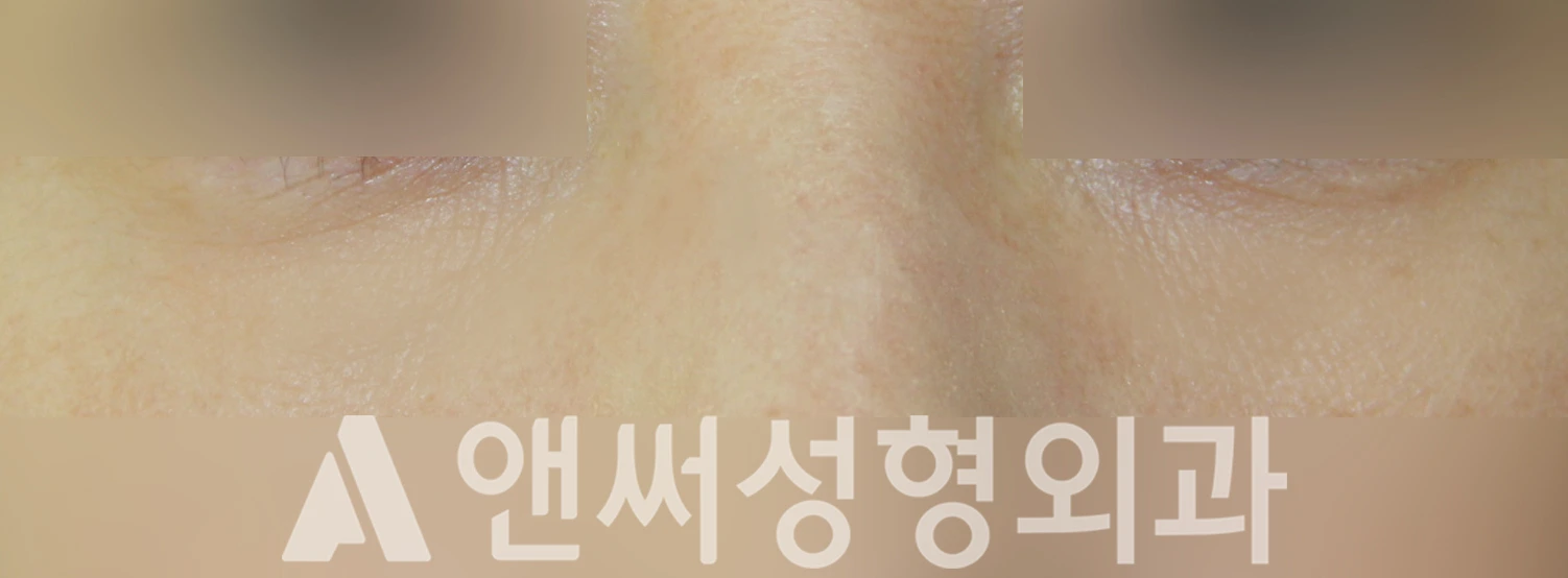 Answer Plastic Surgery case 502: After