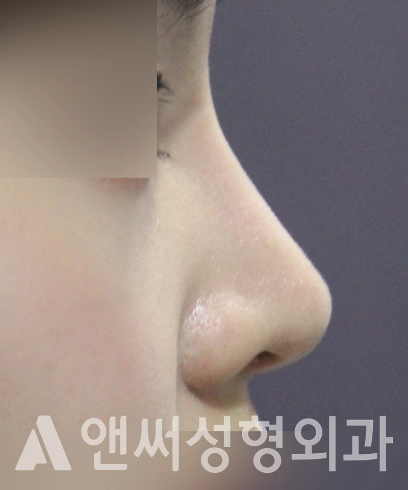 Answer Plastic Surgery case 501: After