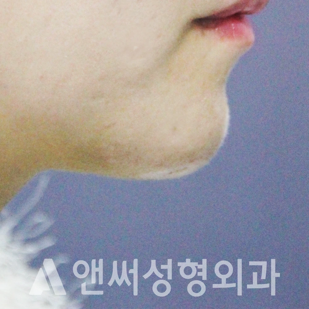 Answer Plastic Surgery case 497: After