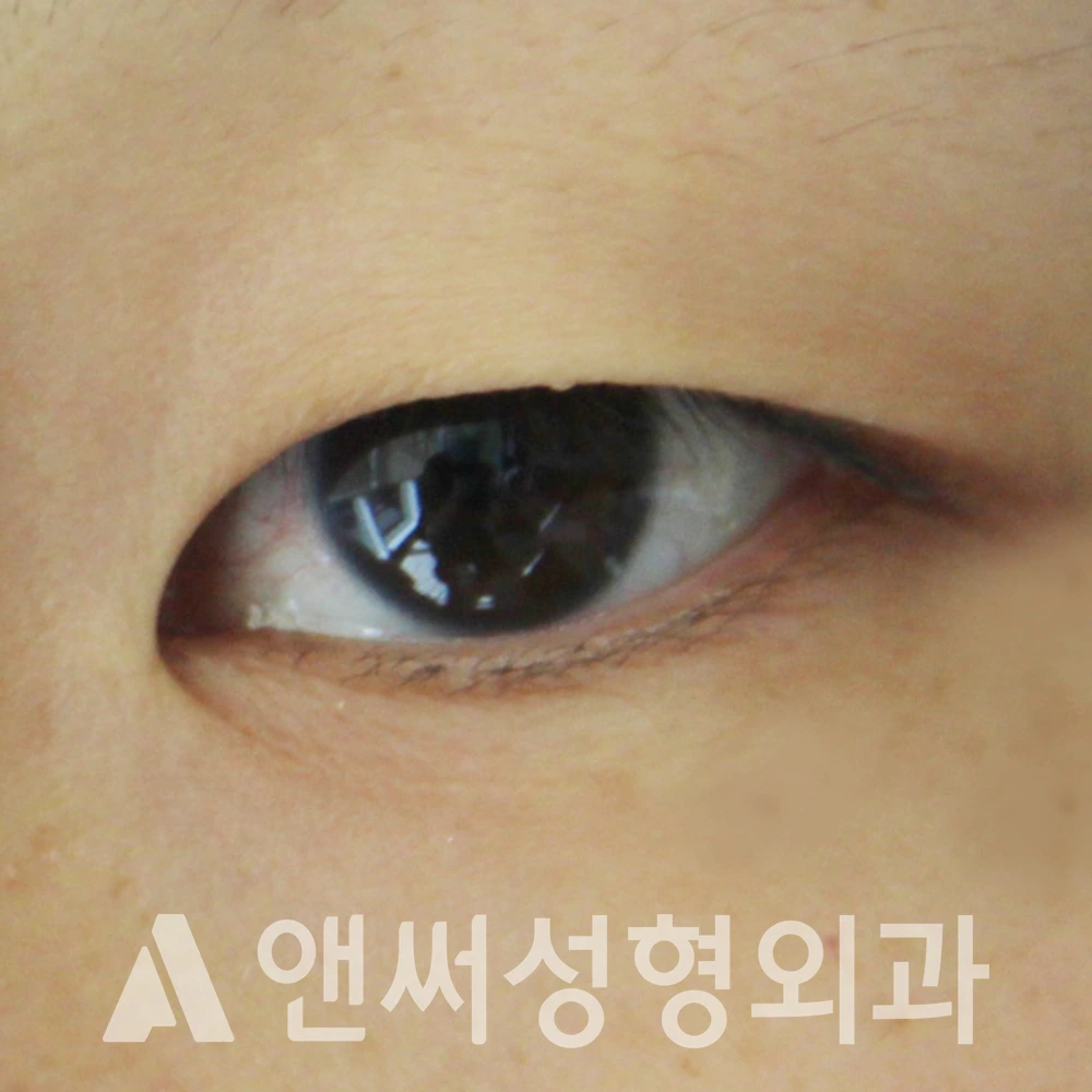 Answer Plastic Surgery case 496: Before