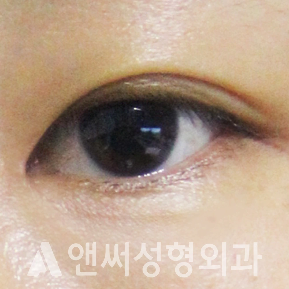 Answer Plastic Surgery case 496: After