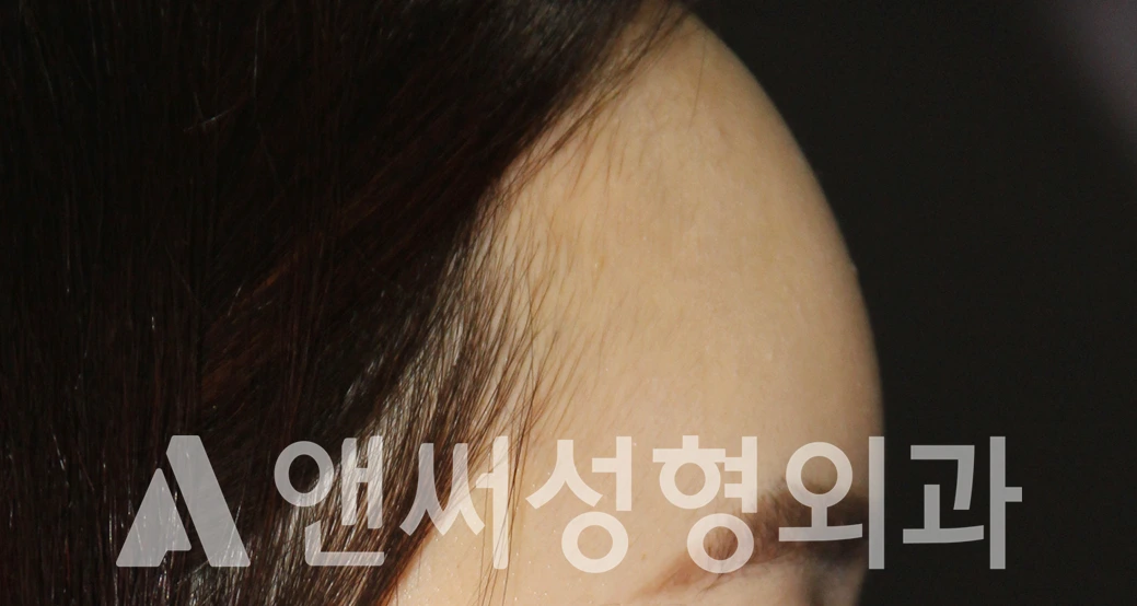 Answer Plastic Surgery case 495: After