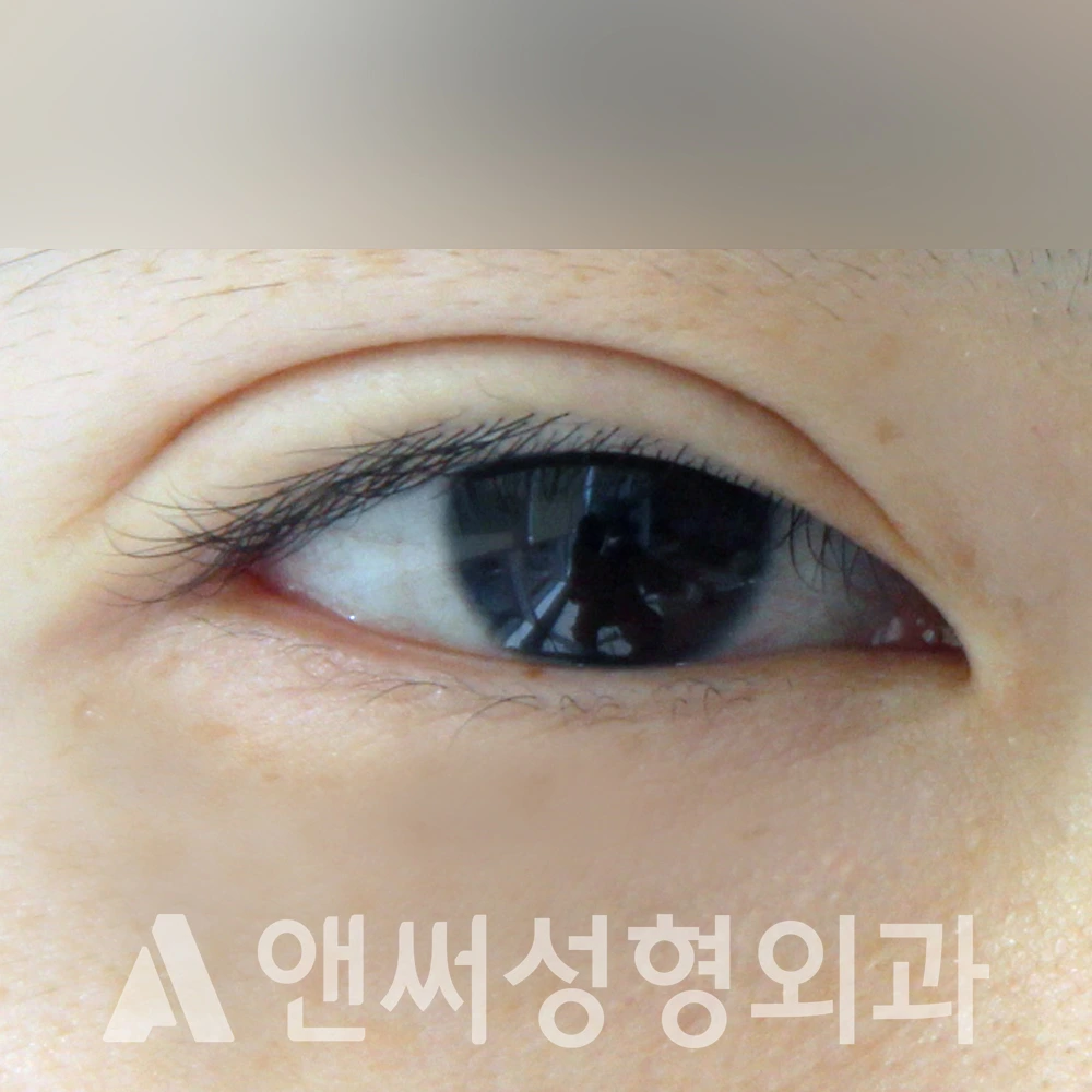 Answer Plastic Surgery case 494: Before