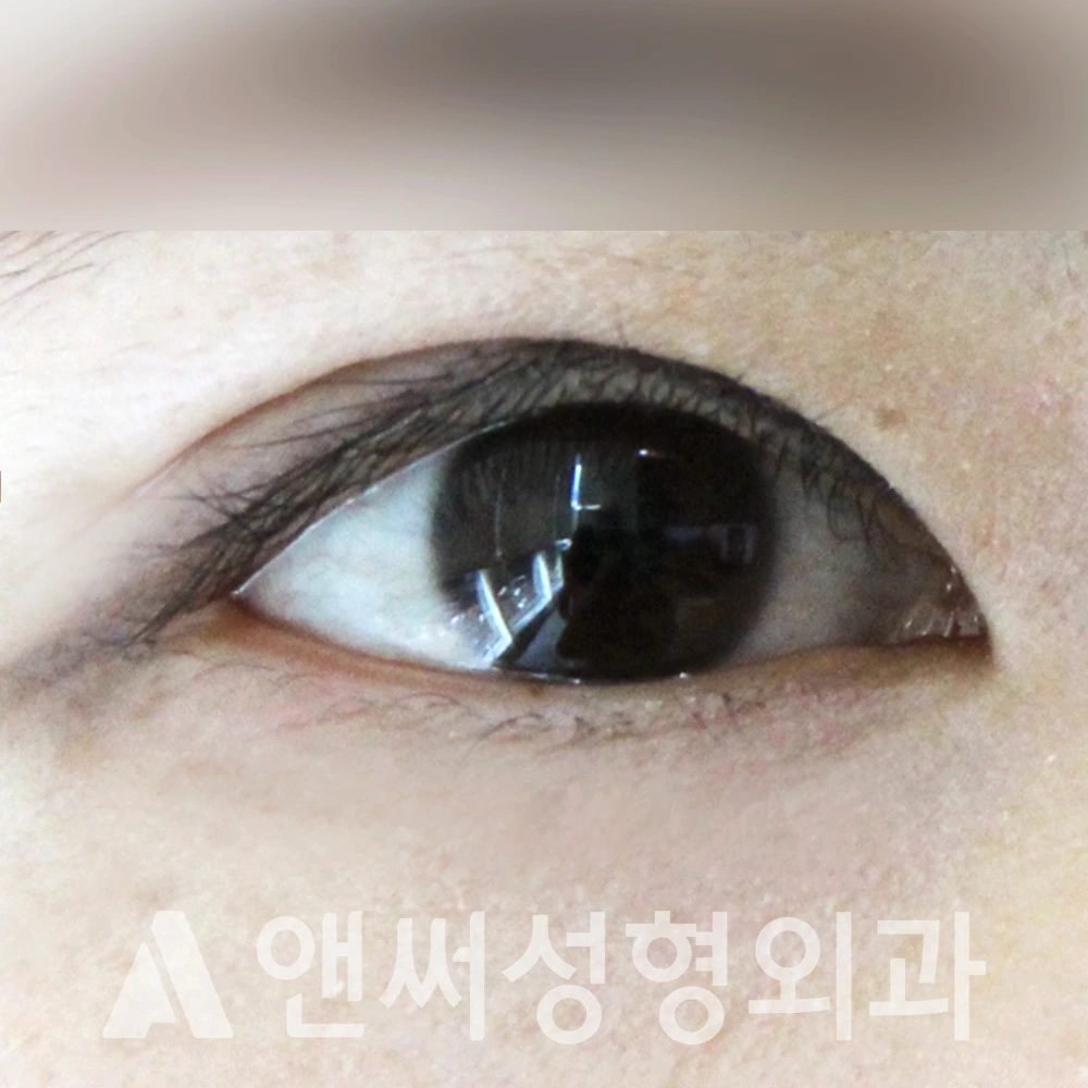 Answer Plastic Surgery case 494: After